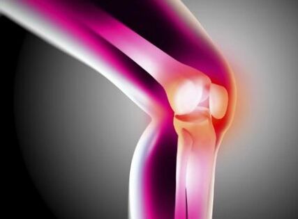 Déformation de l'arthrose