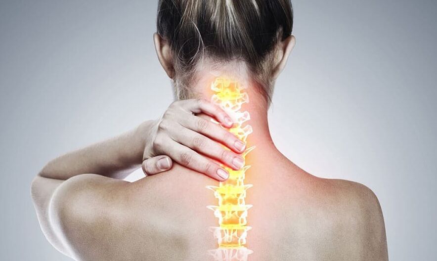 Ostéochondrose de la colonne cervicale.